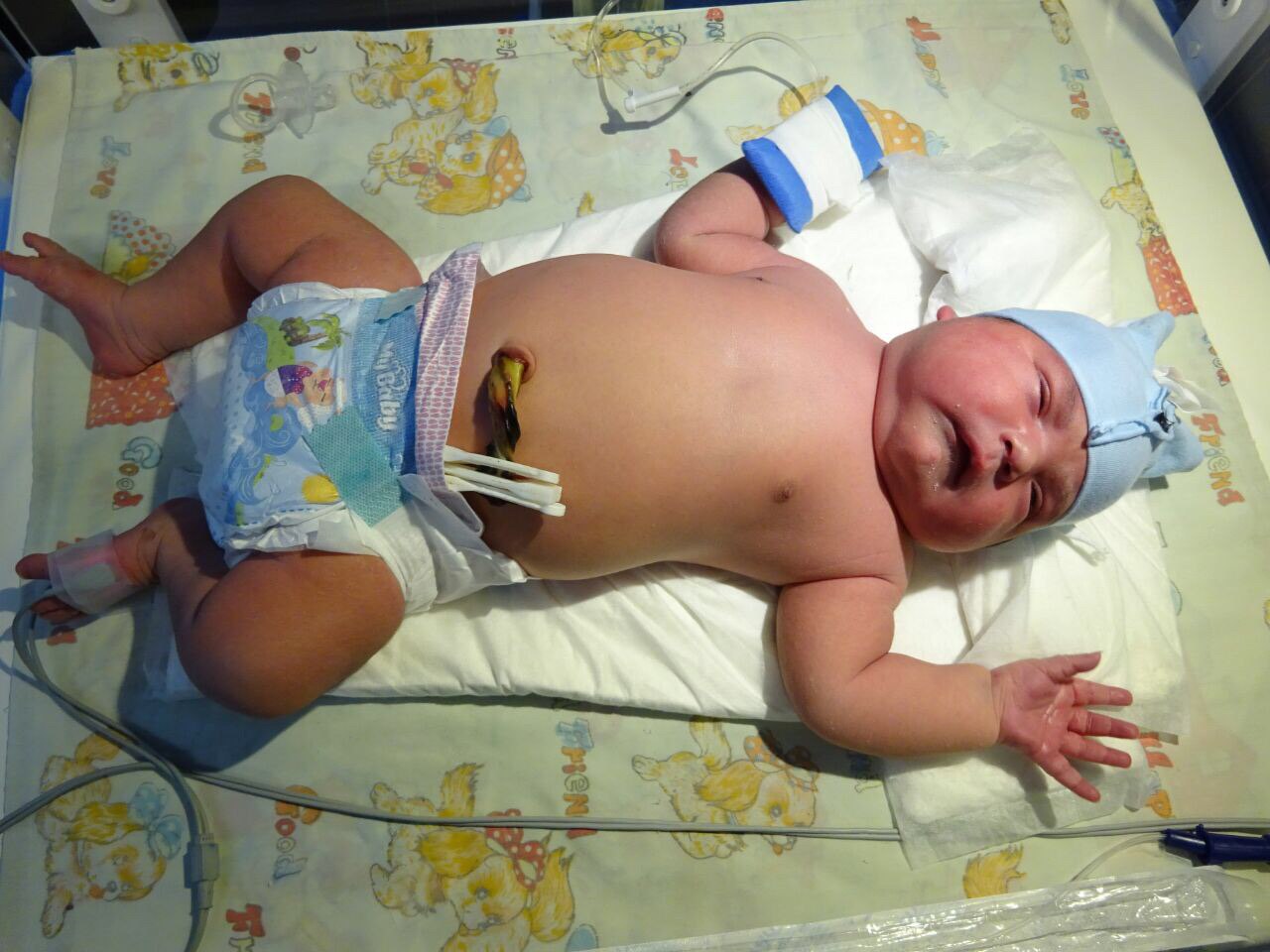 تولد نوزاد 6 کیلویی در میاندوآب